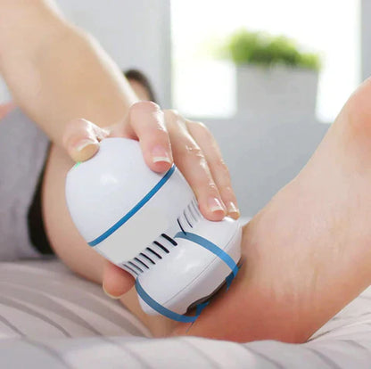 Soréa Vacuum Callus Remover