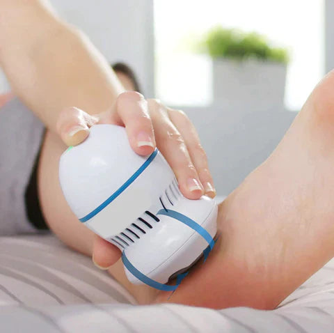 Soréa Vacuum Callus Remover