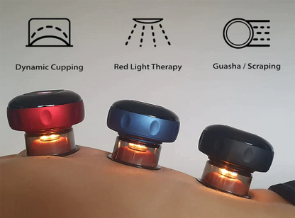 Soréa™ SmartCup
